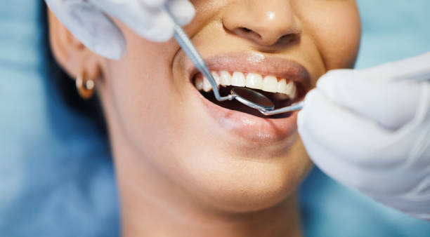 Best Emergency Tooth Extraction in Grasonville, MD
